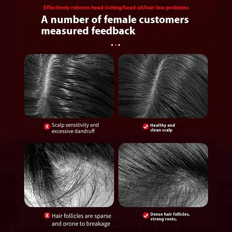 Peigne de massage vibrant élec - Hair Care For Hair Growth avis et prix