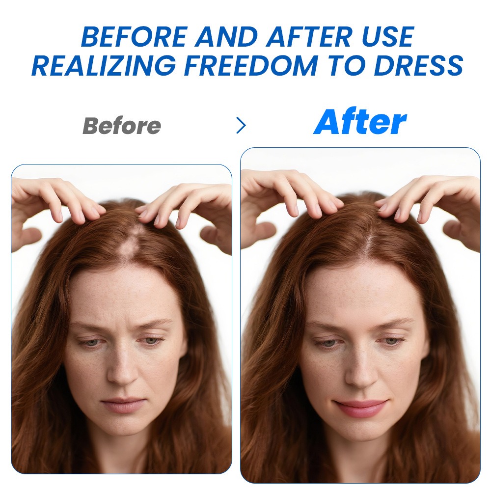 Alopecia Spray de croissance d - Hair Care For Hair Growth avis et prix