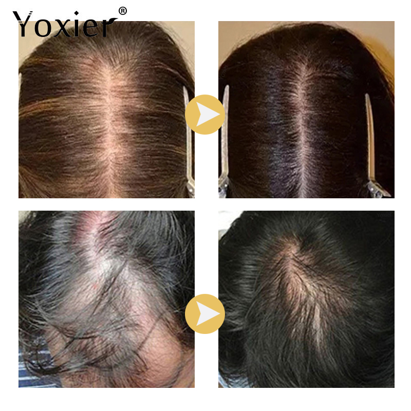 Sérum à croissance Intensive p - Hair Care For Hair Growth avis et prix