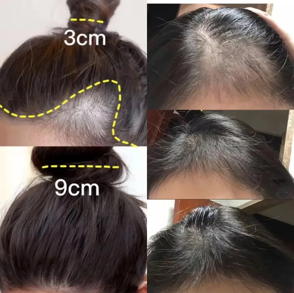 Crème de croissance rapide des - Hair Care Dupes avis et prix