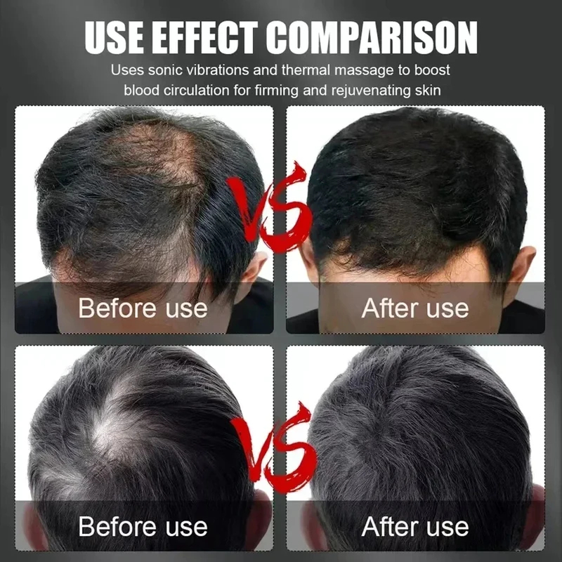Casque de thérapie capillaire  - Hair Care For Hair Growth avis et prix